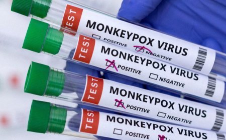 Odisha ready and prepared for monkeypox case management: Health Director